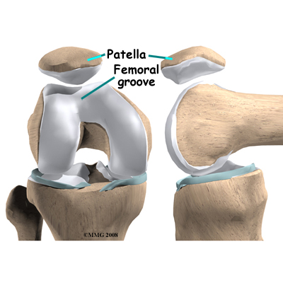patella_groove_anatomy03